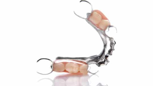 Partial metal denture